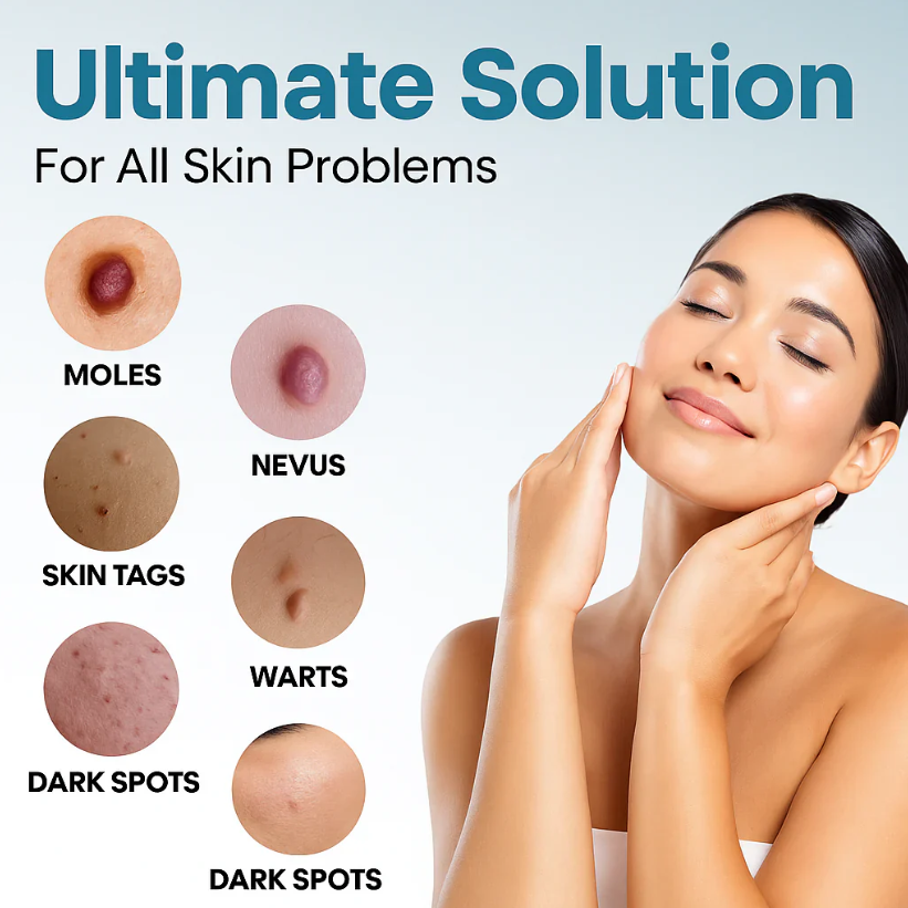 Capry® Mole And Wart Removal Laser Pen